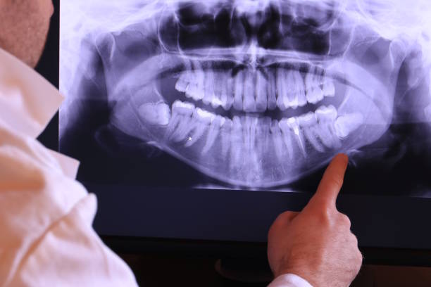Best Tooth Infection Emergency Dentist  in Englewood, FL