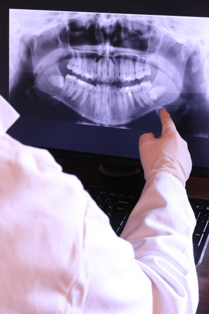 Best Root Canal Emergency Dentist  in Englewood, FL
